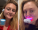 10 best teeth whitening kits, expert-tested to reverse staining