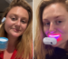 10 best teeth whitening kits, expert-tested to reverse staining