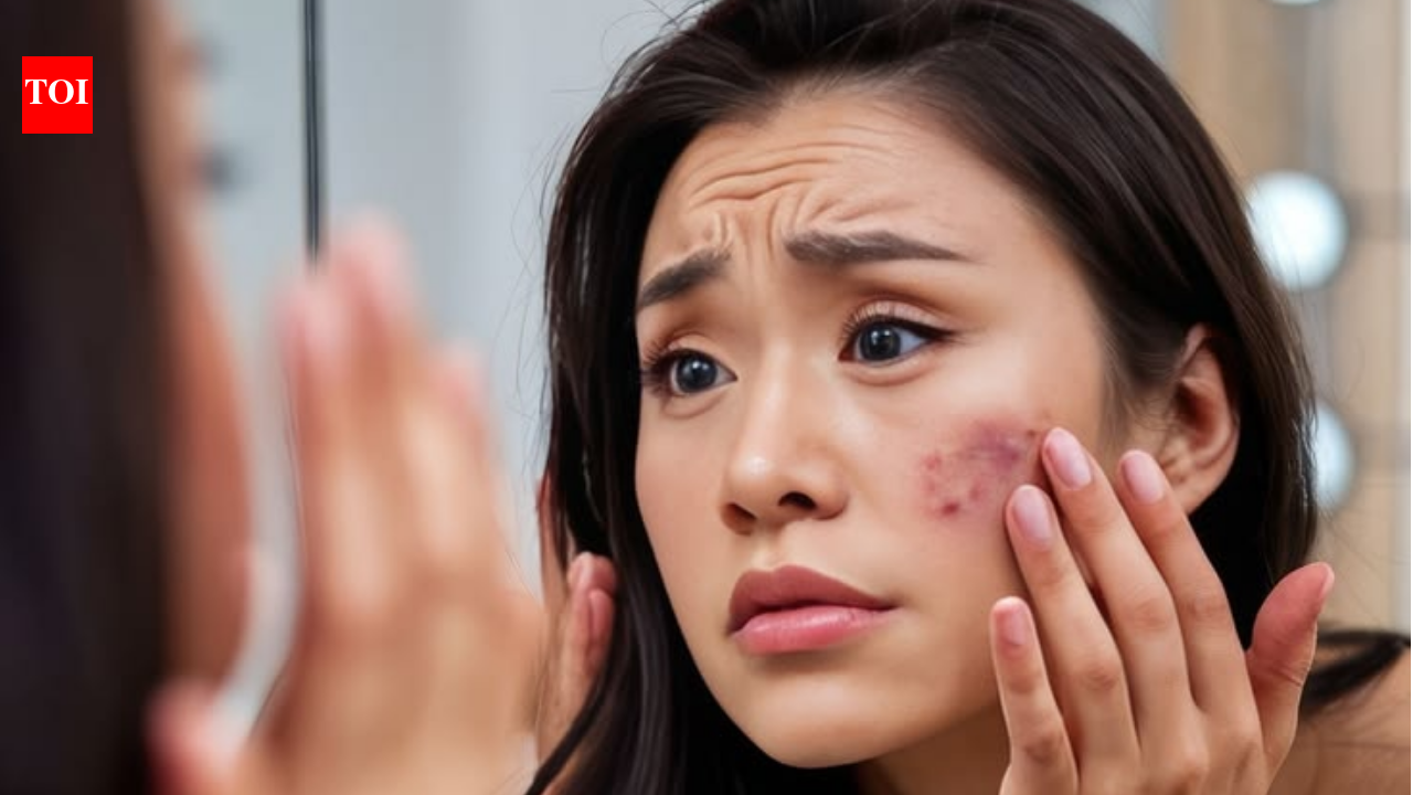 4 DIY skincare combinations you should never try at home